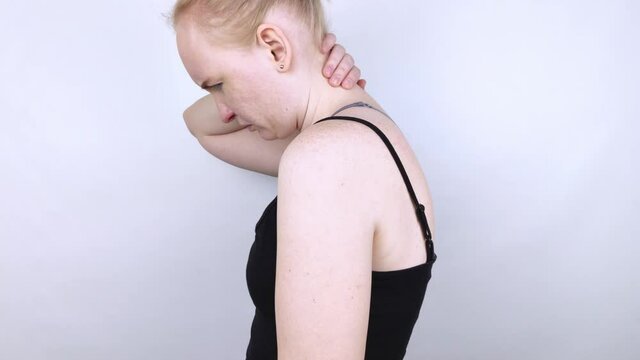 Kyphosis. The woman suffers from a curvature of the spine in the upper section. The cervical vertebrae bulge out and form a hump. Curvature and incorrect posture treatment concept