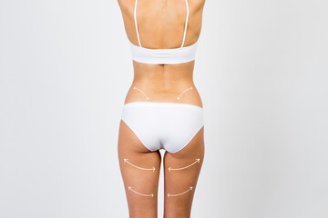 Cellulite removal scheme on body girl. White arrows markings on the waist and legs young girl.