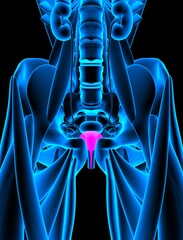female Urinary Bladder x-ray