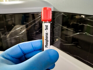 Blood sample tube for Phosphorus test. inorganic phosphate