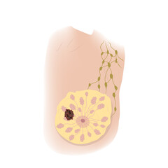 Woman breast. Cancer T2. Medical vector illustration.