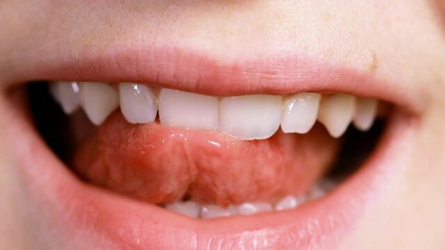 Macro video of a man smiling, shows the tongue chipped tooth. The effect of the cutter's tooth from biting the seeds shell and solid food. For dentists, dental clinics