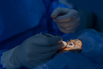 Phacoemulsification, destruction of the opaque lens by ultrasound, ophthalmic eye surgery. eye lens replacement, intraocular lens installation,surgical cataract treatment.Close up photo in blue tone.