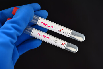 Two nasopharyngeal swab sample positive and negative with COVID-19 virus 