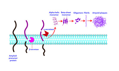 Amyloid plaque formation [Alzheimer]