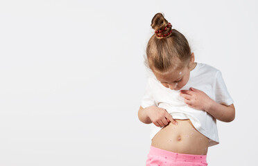 Portrait of a little child girl with chickenpox. Points with a finger at a red pimple on the...