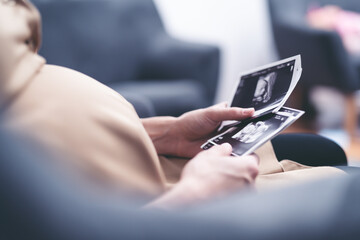 Zdjęcie ciążowe USG