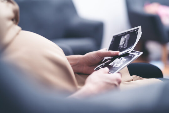 Zdjęcie ciążowe USG