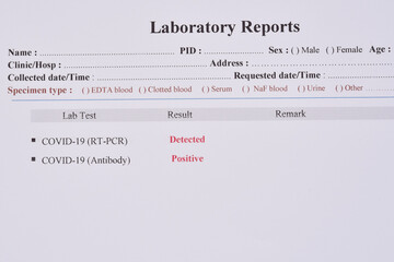 COVID-19 test results by using RT-PCR method and rapid test antibody method, the results showed...