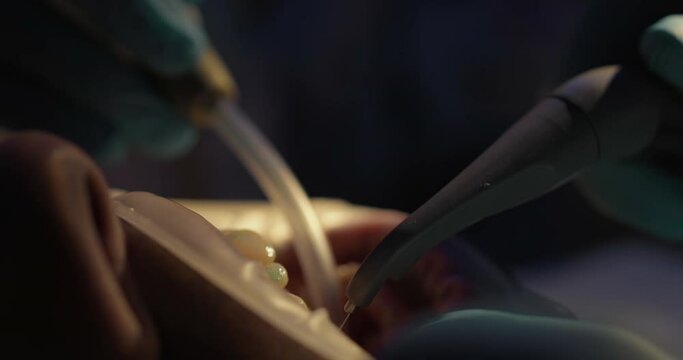 Close up male face with an optragate on his mouth who is having teeth cleaning by the dentist by using handpiece dental water spray and saliva ejector.
