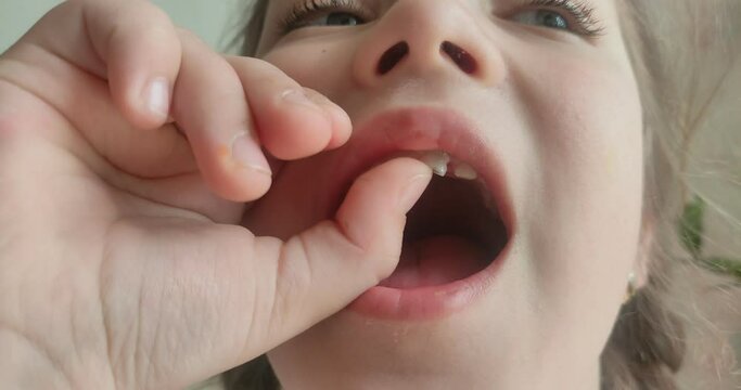 Little girl child shakes her baby tooth which should fall out