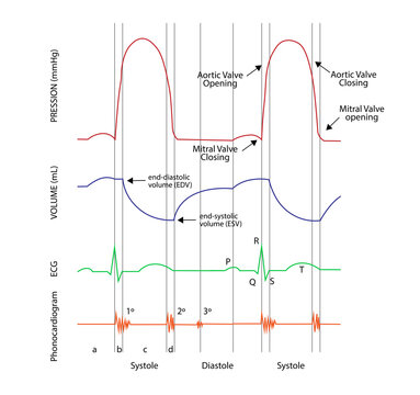Left ventricular pressure-volume (PV) loops, electrocardiogram (ECG) and Phonocardiogram curves