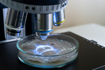 Bacteria in a Petri dish under the magnification of the microscope objectives, the close-up. Focus...