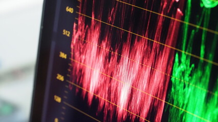 Color grading indicator graph on screen. RGB colour correction graphic bar on monitor in post...