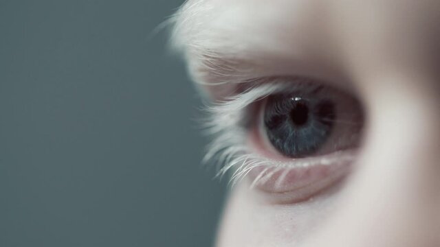 Eye Human with Beautiful Blue Iris Macro Shot. Bright Beauty Boy Open Eyes with Pupil Dilation. Extreme Close-up Blond Kid Clear Looking Forward. Contracting Albinism Skin on Body. View Concept 4k