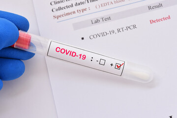 Nasopharyngeal swab positive with COVID-19 test by using RT-PCR method 