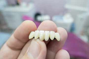 dental ceramic metal bridges in the hands