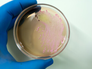 Salmonella colonies on ss agar, salmonella black colonies, Enterobacteriaceae, Microbiology