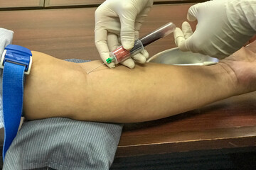 The doctor draw the patient's blood by syringe
