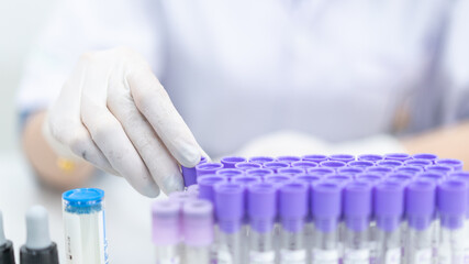 A young woman researcher, doctor, scientist, or laboratory assistant working with plastic medical tubes to research, examine scientific experiments in a modern laboratory. Education stock photo