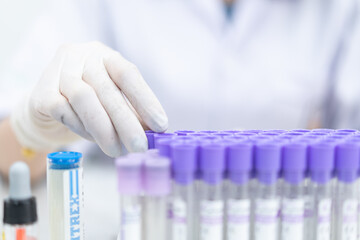 Close-up and selective focus shoot of a microscope, medical test tubes with liquid, and other modern laboratory equipment in a laboratory room. Education stock photo