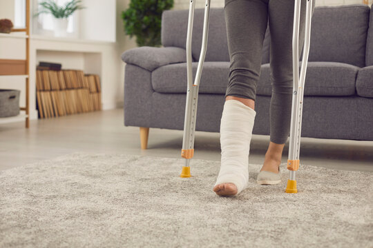Concept of injury in domestic or car accident, rehabilitation and successful recovery. Young woman with broken leg in cast makes good progress she stands up from sofa and walks at home using crutches