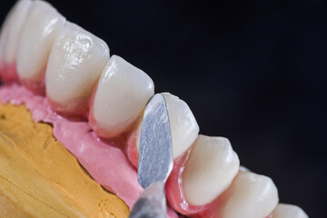 Dental technician with tool applied glaze on ceramic crown