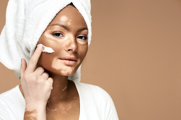 Moisturizing skin concept. African American woman with vitiligo applies moisturizing cream on her face, on a pastel background