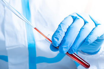 Macro close up of scientist or doctor hands working with blood. Covid 19 blood test concept. Glass pipette and tube. Coronavirus variant test. New virus strain mutation research and discovery.