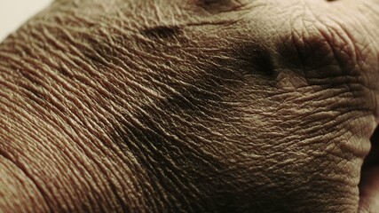 Close up of Senior's hands with Alzheimer disease