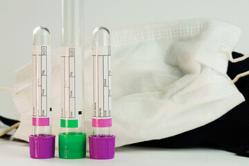 Vacuum tubes for collection and blood samples on white background together with black and white...