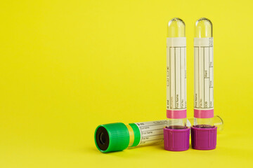 vacuum tubes for collection and blood samples on yellow background..Transparent with purple and...