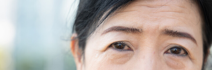 old aging senior woman having wrinkle facial skin and crow’s feet on her face, concept of skin care, face care, aging skin