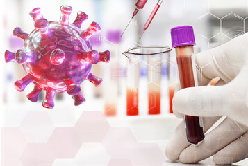 covid-19 virus. scientist testing of human blood in laboratory for diagnosis coronavirus.