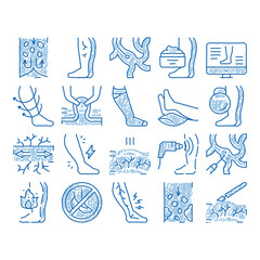 Varicose Veins Disease icon hand drawn illustration