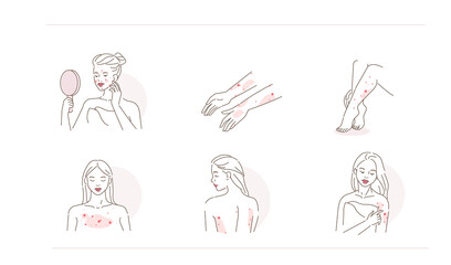 Beauty Girl Have Allergy and Acne Skin Problems. Woman Scratching her Body and Face with Hand. Allergic Dermatitis, Eczema or Nettle Rash with Itch Symptoms. Flat Line Cartoon Vector Illustration.