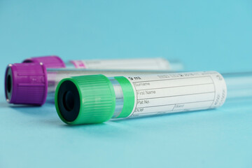 vacuum tubes for collection and blood samples on blue background..Transparent with purple and green lid. Label to identify the data. Selective focus.