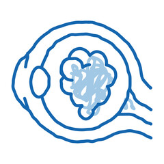 Cataract Eyes doodle icon hand drawn illustration