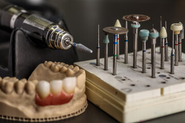 Dental implant. Restoration of teeth. Dental surgeon. Dental laboratory. Dental clinic. Implants of the jaw of a person. Visual materials at the dentist's office. Oral health.