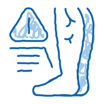 Cold Feet Due Atherosclerosis, Health Problem Doodle Icon Hand Drawn Illustration