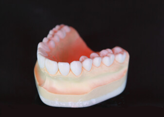 Waxing the loosing teeth for dental treatment plan