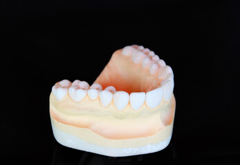 Fototapeta na wymiar Waxing the loosing teeth for dental treatment plan
