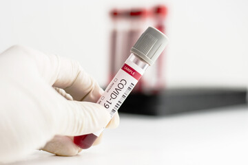Fototapeta premium Hand wear glove holding blood test tube with covid - 19 code for corona virus.