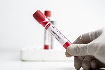 Hand wear glove holding blood test tube with covid - 19 code for corona virus.