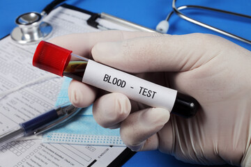 Blood test , vacuum tube with blood in the doctor's hand, selective focus, close-up.