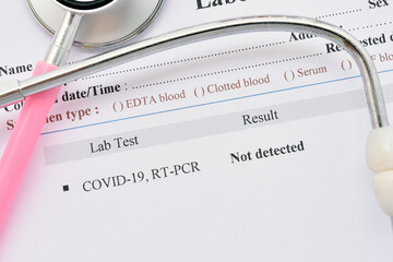 COVID-19 not detected result, laboratory report of COVID-19 testing by using RT-PCR method, the...