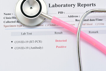 COVID-19 test results by using RT-PCR method and rapid test antibody method, the results both...