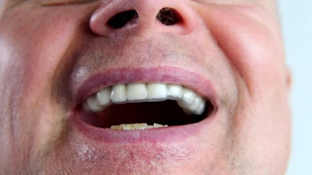 doctor examines the oral cavity of a male patient with abraded enamel on the lower jaw, tries on a silicone pad on the teeth for sleeping, concept dental services, remedy for grinding teeth