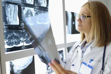 Female doctor examines an X-ray in medical office.