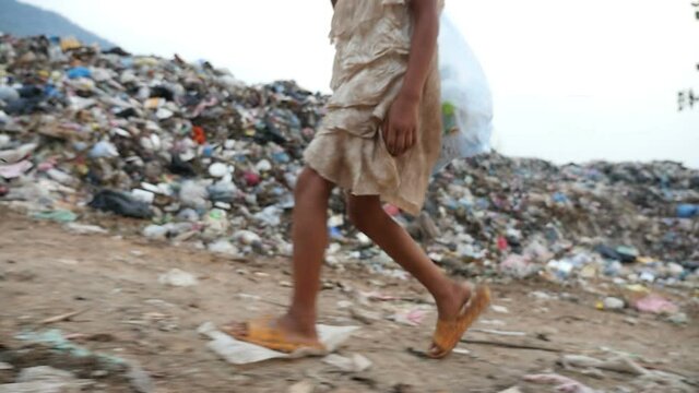 Poor Legs Kid Walking, Garbage At Background
